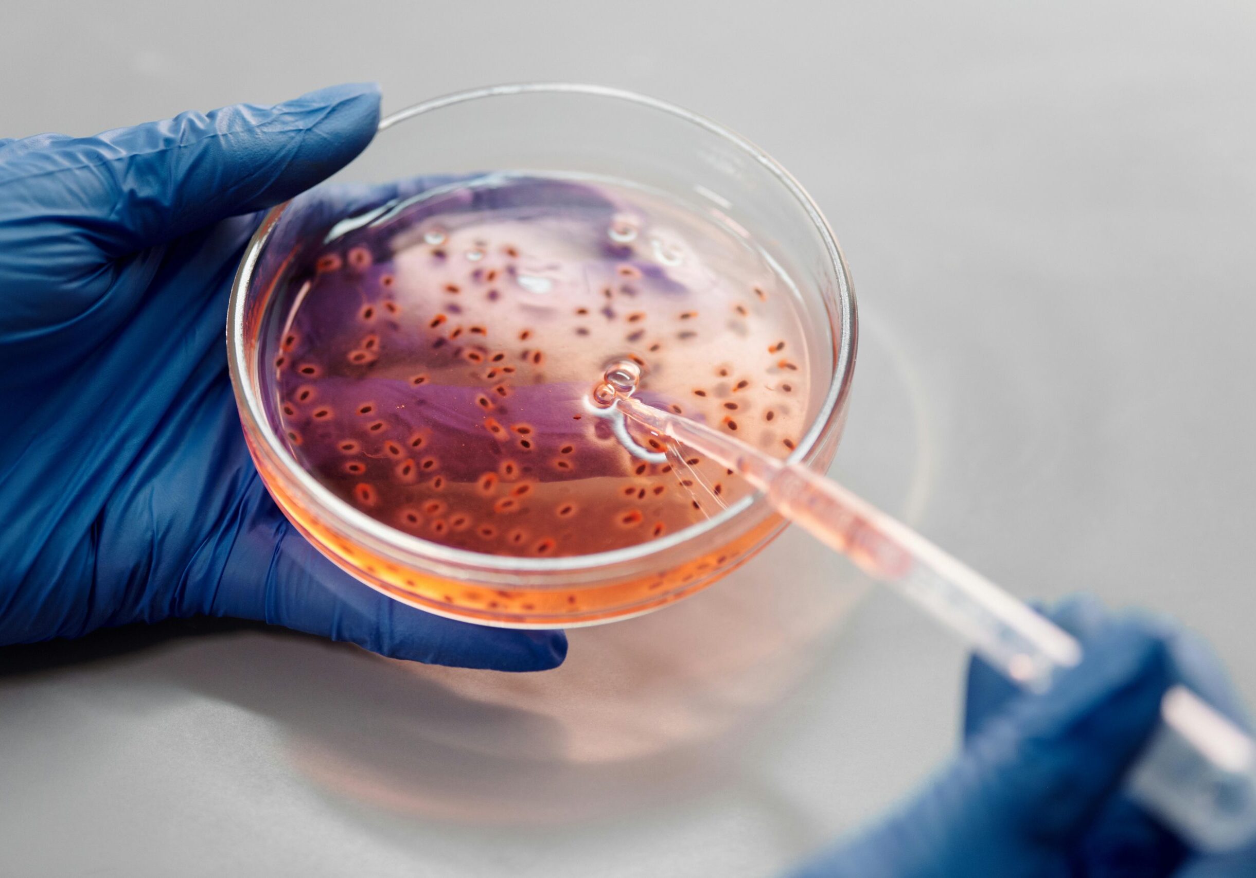 pexels-edward-jenner-4031442